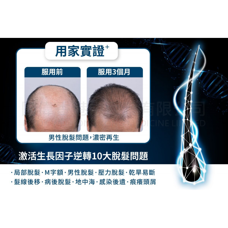 WholeLove Hair 愛完全活髮系列 全爆髮醫學級細胞復甦配方 (60粒)