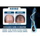 WholeLove Hair 愛完全活髮系列 全爆髮醫學級細胞復甦配方 (60粒)